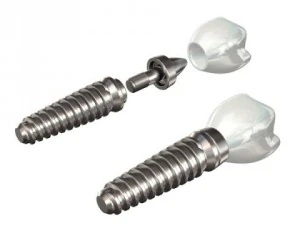 dental implant 3D Model