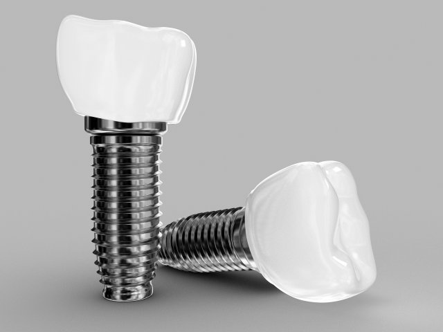 implant Modello 3D .c4d .max .obj .3ds .fbx .stl .blend 