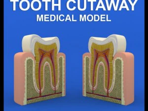 вырез зуба 3D Модель