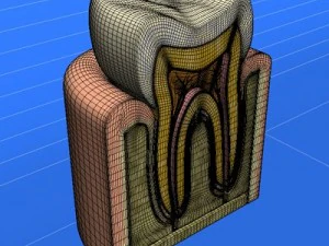 tooth cutaway 3D Model
