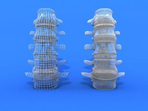 lumbar vertebrae and spinal cord 3D Model