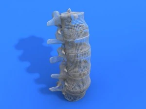 lumbar vertebrae and spinal cord 3D Model