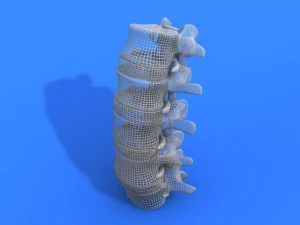 lumbar vertebrae and spinal cord 3D Model
