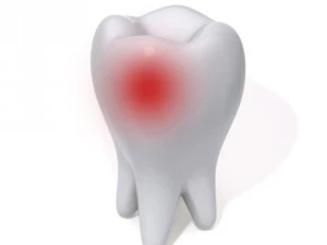 tooth 3D Model