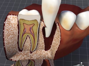 teeth and gums anatomy 3D Model