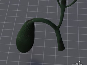 gall bladder Model 3D