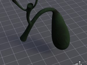 gall bladder Model 3D