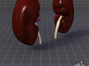kidney external 3D 모델