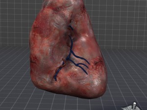 spleen 3D Model
