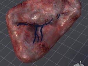 spleen 3D मॉडल