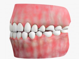 teeth with gums 3D Model