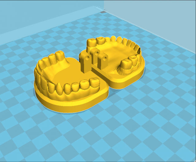 model dental Model do druku 3D .c4d .max .obj .3ds .fbx .stl .blend