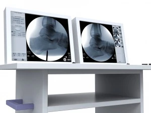 C-arm x-ray machine 3D Model