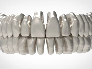 dental anatomy library with thimble crowns - azure 3D Print Model