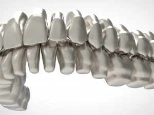 dental anatomy library with thimble crowns - azure 3D Print Model
