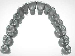 dental anatomy library with thimble crowns - azure 3D Print Model
