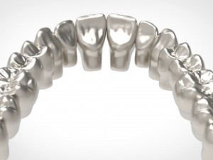 dental anatomy library with thimble crowns - azure Model do druku 3D