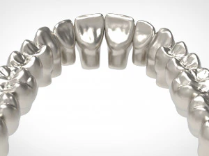 dental anatomy library with thimble crowns - azure 3D Print Model