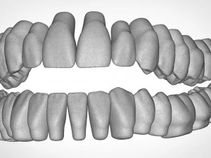 dental anatomy library with thimble crowns - azure 3D Print Model