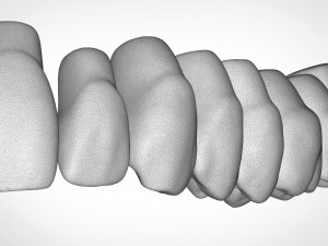 dental anatomy library with thimble crowns - azure Model do druku 3D