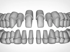 dental anatomy library with thimble crowns - azure 3D Print Model