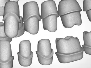 dental anatomy library with thimble crowns - azure 3D Print Model
