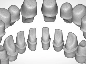 dental anatomy library with thimble crowns - azure 3D Print Model