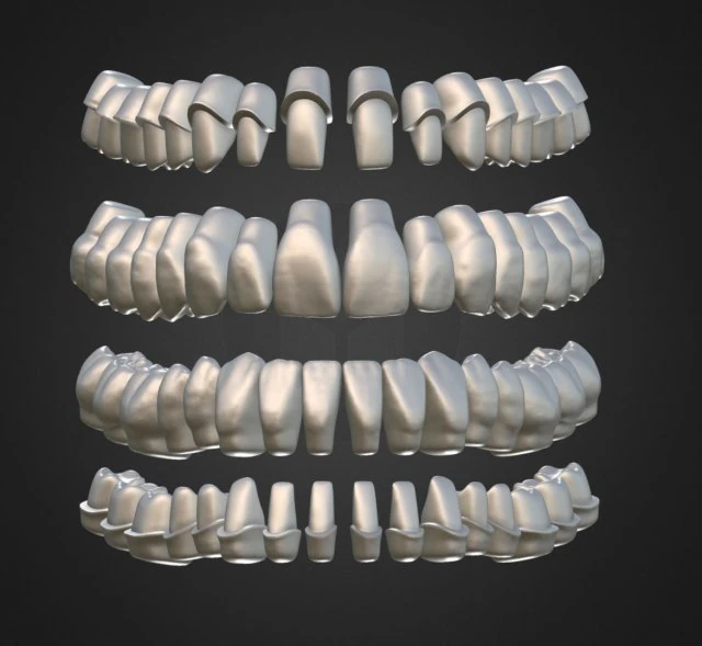 dental anatomy library with thimble crowns - azure 3D Print Model .c4d .max .obj .3ds .fbx .stl .blend 