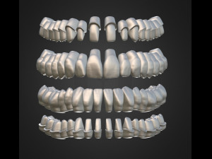 dental anatomy library with thimble crowns - azure 3D Print Model