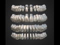 Dental Anatomy Library with Thimble Crowns - Azure 3D Model