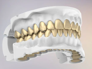 Replica 3D delle mascelle dentali con denti staccabili Modello di stampa 3D