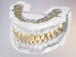 3D Dental Jaws Replica with Detachable Teeth Modèles 3D en vedette