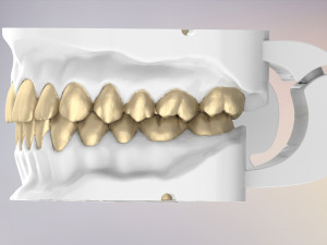 3D Dental Jaws Replica with Detachable Teeth Modèles 3D en vedette