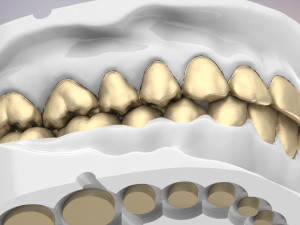 3D Dental Jaws Replica with Detachable Teeth Modèles 3D en vedette