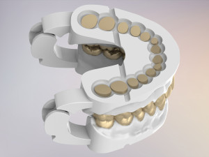 3D Dental Jaws Replica with Detachable Teeth Modèles 3D en vedette