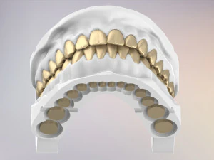 3D Dental Jaws Replica with Detachable Teeth 3D Print Model
