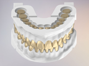 3D Dental Jaws Replica with Detachable Teeth Modèles 3D en vedette