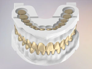 3D Dental Jaws Replica with Detachable Teeth 3D Print Model