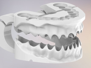 3D Dental Jaws Replica with Detachable Teeth Modèles 3D en vedette