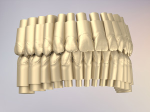 3D Dental Jaws Replica with Detachable Teeth Modèles 3D en vedette