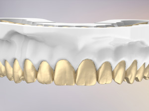3D Dental Jaws Replica with Detachable Teeth Modèles 3D en vedette