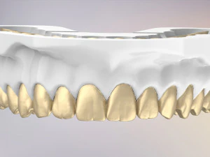 3D Dental Jaws Replica with Detachable Teeth 3D Print Model