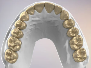 3D Dental Jaws Replica with Detachable Teeth 3D Print Model