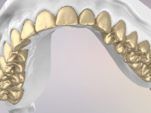 3D Dental Jaws Replica with Detachable Teeth Modèles 3D en vedette