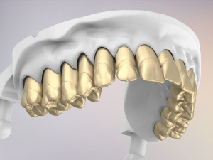 3D Dental Jaws Replica with Detachable Teeth Modèles 3D en vedette