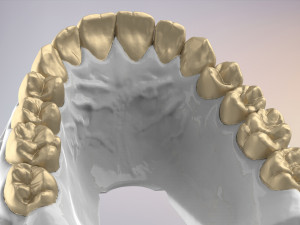 3D Dental Jaws Replica with Detachable Teeth Modèles 3D en vedette