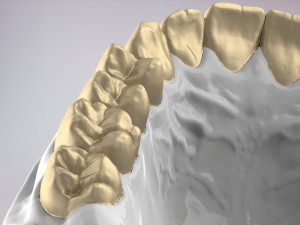 3D Dental Jaws Replica with Detachable Teeth Modèles 3D en vedette