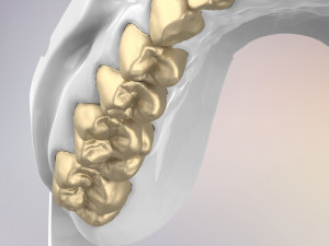 3D Dental Jaws Replica with Detachable Teeth Modèles 3D en vedette