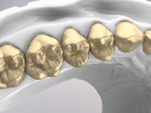 3D Dental Jaws Replica with Detachable Teeth Modèles 3D en vedette
