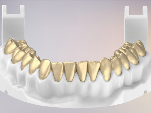 3D Dental Jaws Replica with Detachable Teeth Modèles 3D en vedette